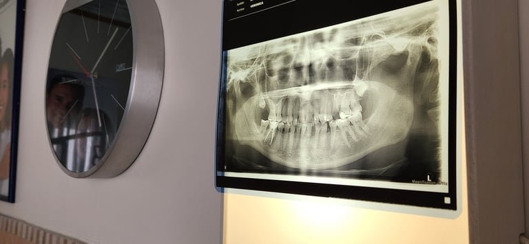 radiografia bucal
